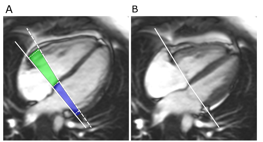 Longitudinal contribution to stroke volume context from the manuscript image cache