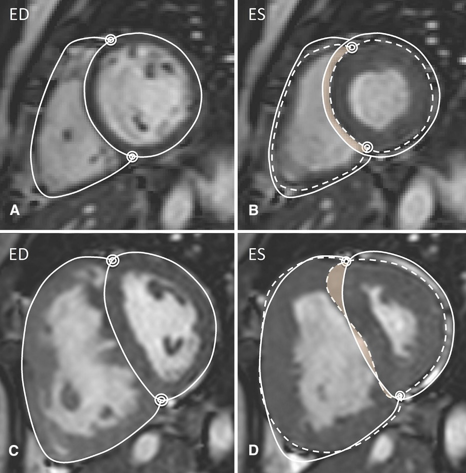 Septal and lateral contribution context from the manuscript image cache