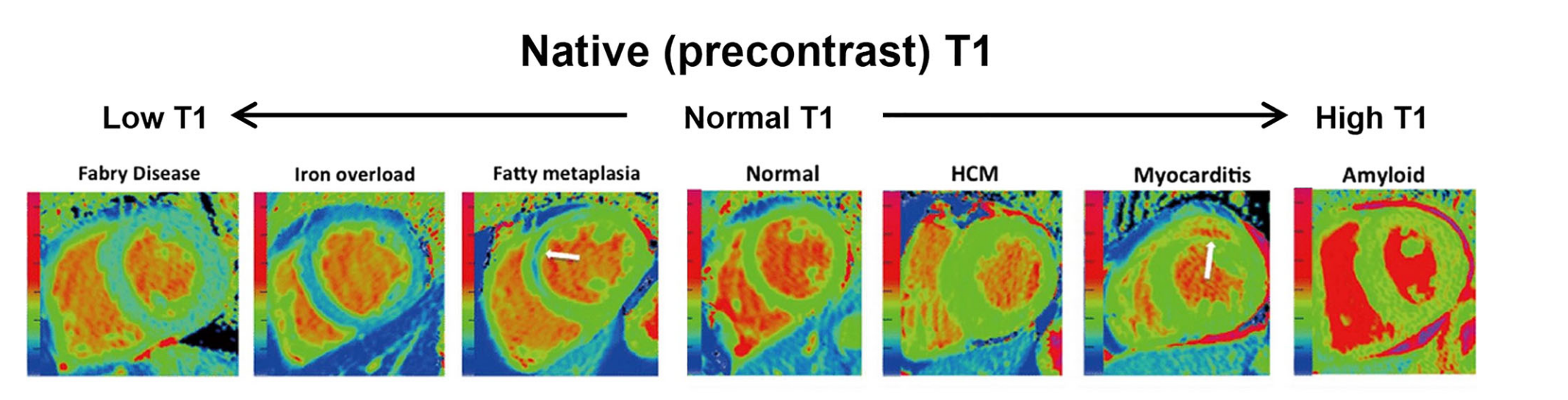 Native T1 mapping clinical context from the manuscript image cache